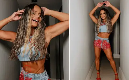 Hérnia umbilical: veja mitos e verdades sobre o problema de Viviane Araujo