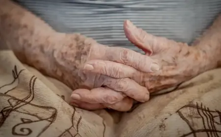 Demência em idosos hospitalizados não é percebida em até 50% dos casos