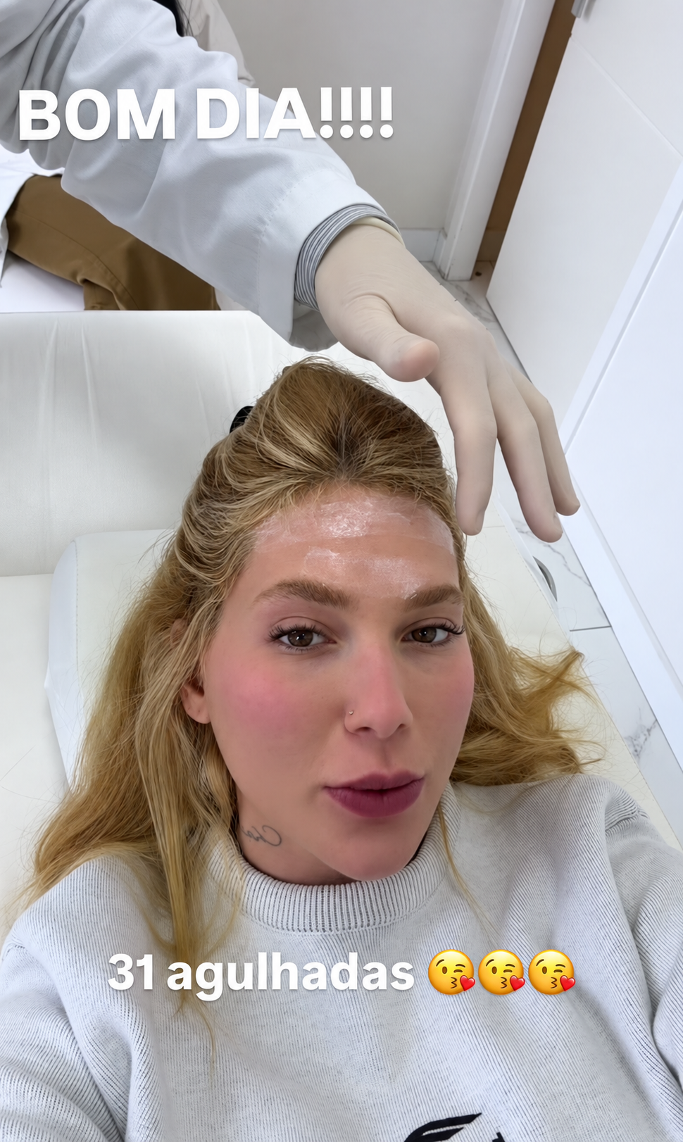 Por que aplicação de botox na cabeça pode ser usada contra enxaqueca?
